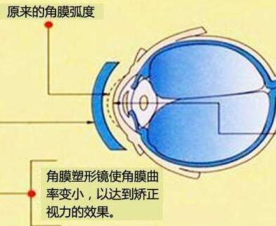 視欣視力恢復加盟